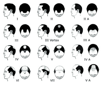 The Hamilton-Norwood classification