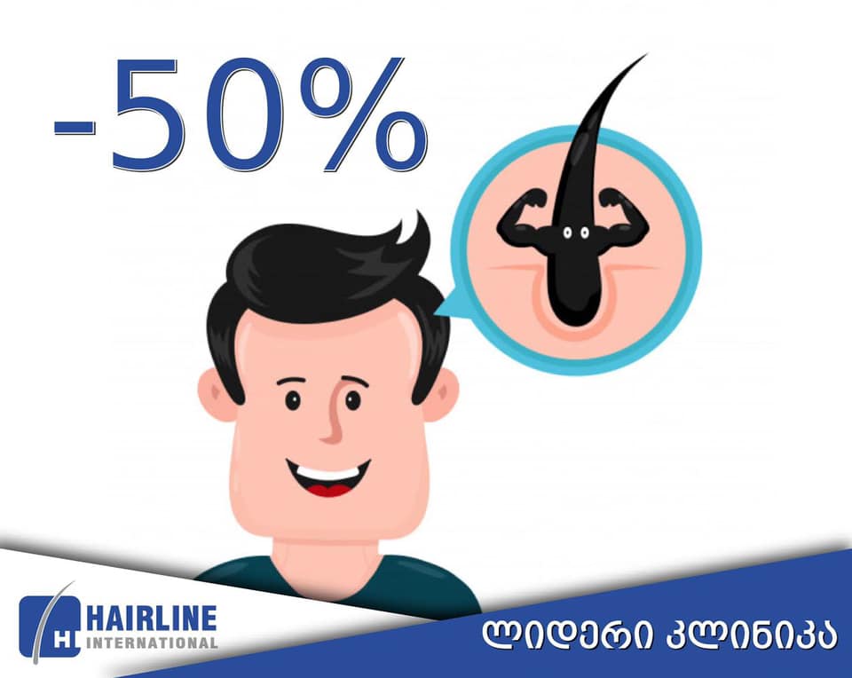 50 პროცენტიანი ფასდაკლება თმის გადანერგვაზე