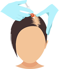 hair loss treatment