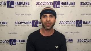 Natik from Israel თმის გადანერგვა საქართველოში hair transplant in georgia tmis gadanergva sakartveloshi